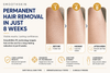 SmoothSkin Laser Hair Remover - Skin Bliss Shop